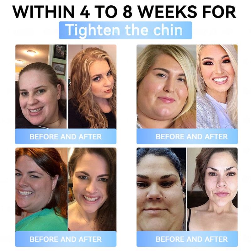 FDA Official Store | Myo Clinic GLP-1 Slim & Firm Nano Microneedle Patch with Collagen, Turmeric & Matrixyl 3000丨Obesity, Cardiovascular Disease, Diabetes, Sleep Apnea, Joint Problems and More