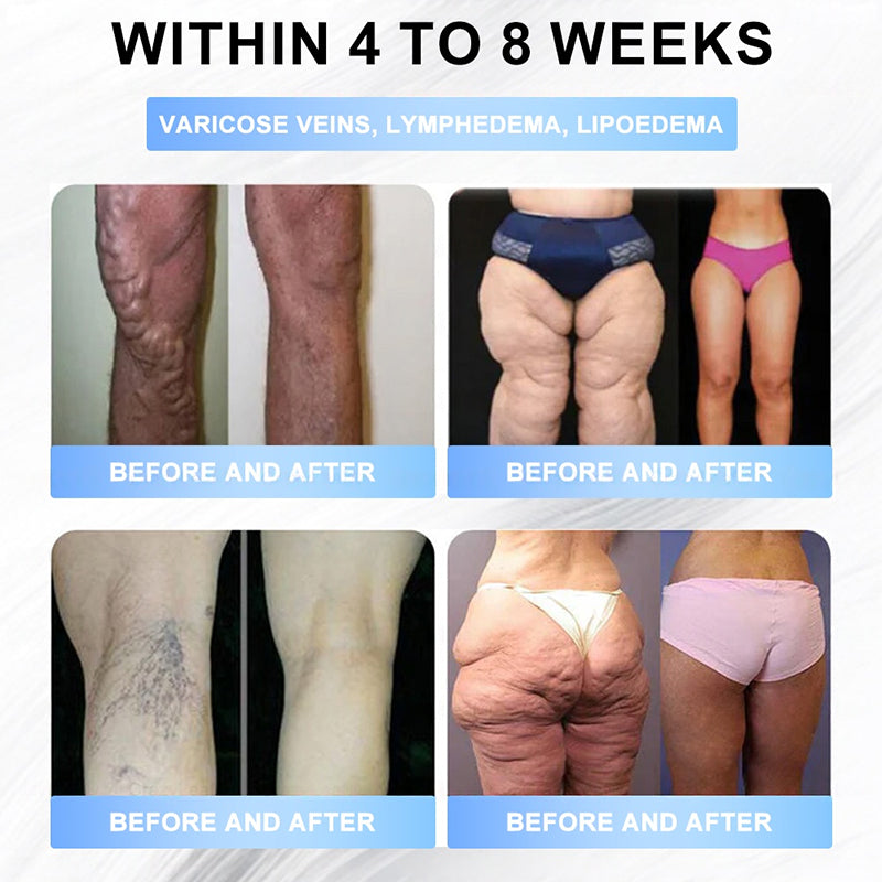 FDA Official Store | Myo Clinic GLP-1 Slim & Firm Nano Microneedle Patch with Collagen, Turmeric & Matrixyl 3000丨Obesity, Cardiovascular Disease, Diabetes, Sleep Apnea, Joint Problems and More